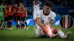 Christian Pulisic mengalami cedera saat menghadapi Belgia yang memperpanjang krisis Amerika Serikat di Piala Dunia 2026.